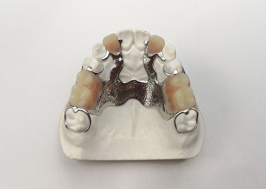 Partial Denture