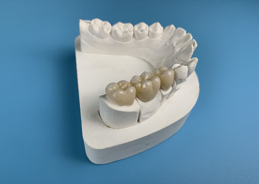 Full Zirconia