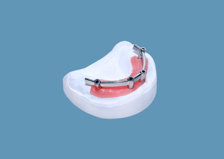 Implant Bar